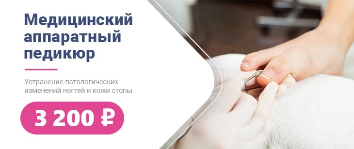 Медицинский аппаратный педикюр = 3200 рублей